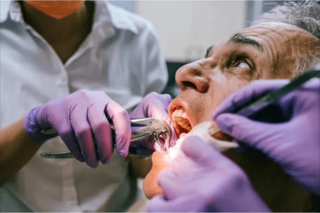 showing a tooth extraction site